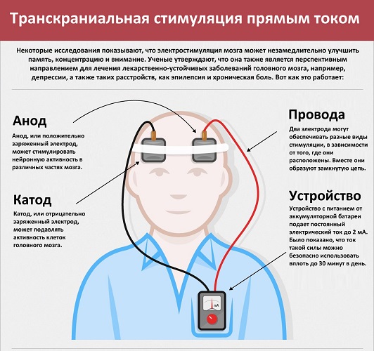 Същността на техниката на TDCS
